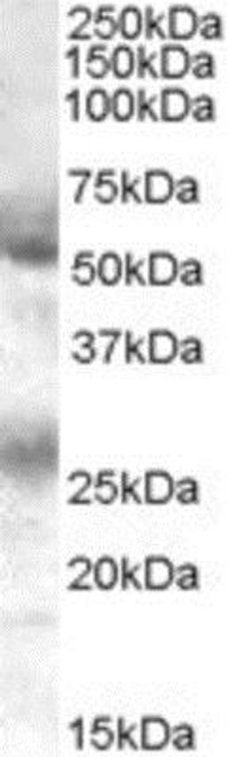 Western Blot: FLVCR Antibody [NB100-1481] - (0.1ug/ml) staining of Human Bone Marrow lysate (35ug protein in RIPA buffer). Primary incubation was 1 hour. Detected by chemiluminescence.