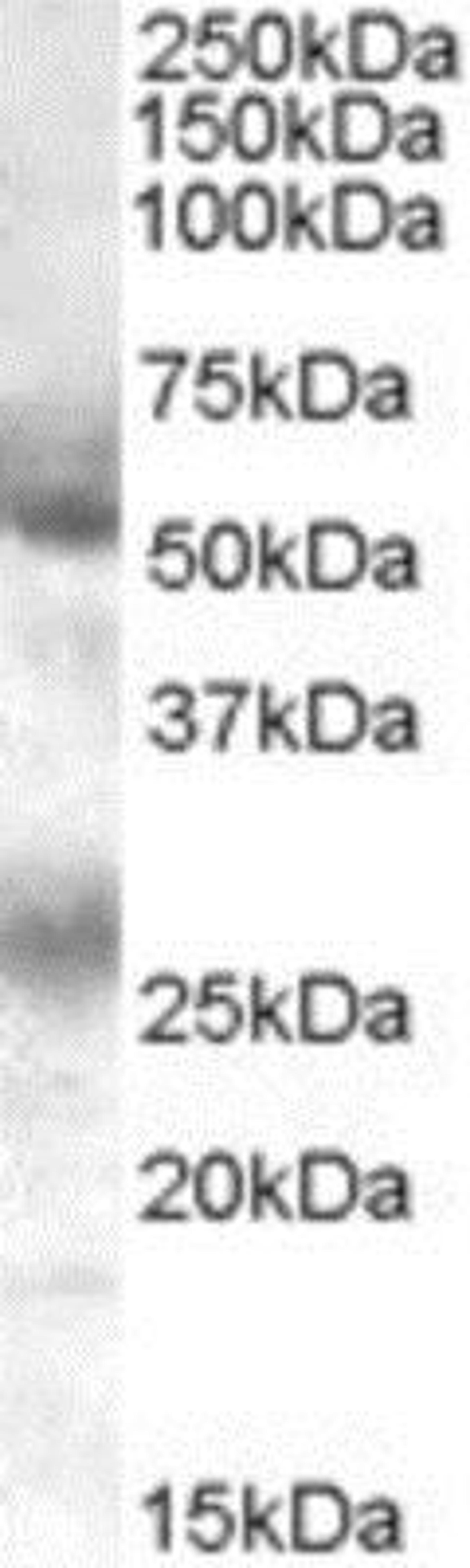 Western Blot: FLVCR Antibody [NB100-1481] - (0.1ug/ml) staining of Human Bone Marrow lysate (35ug protein in RIPA buffer). Primary incubation was 1 hour. Detected by chemiluminescence.