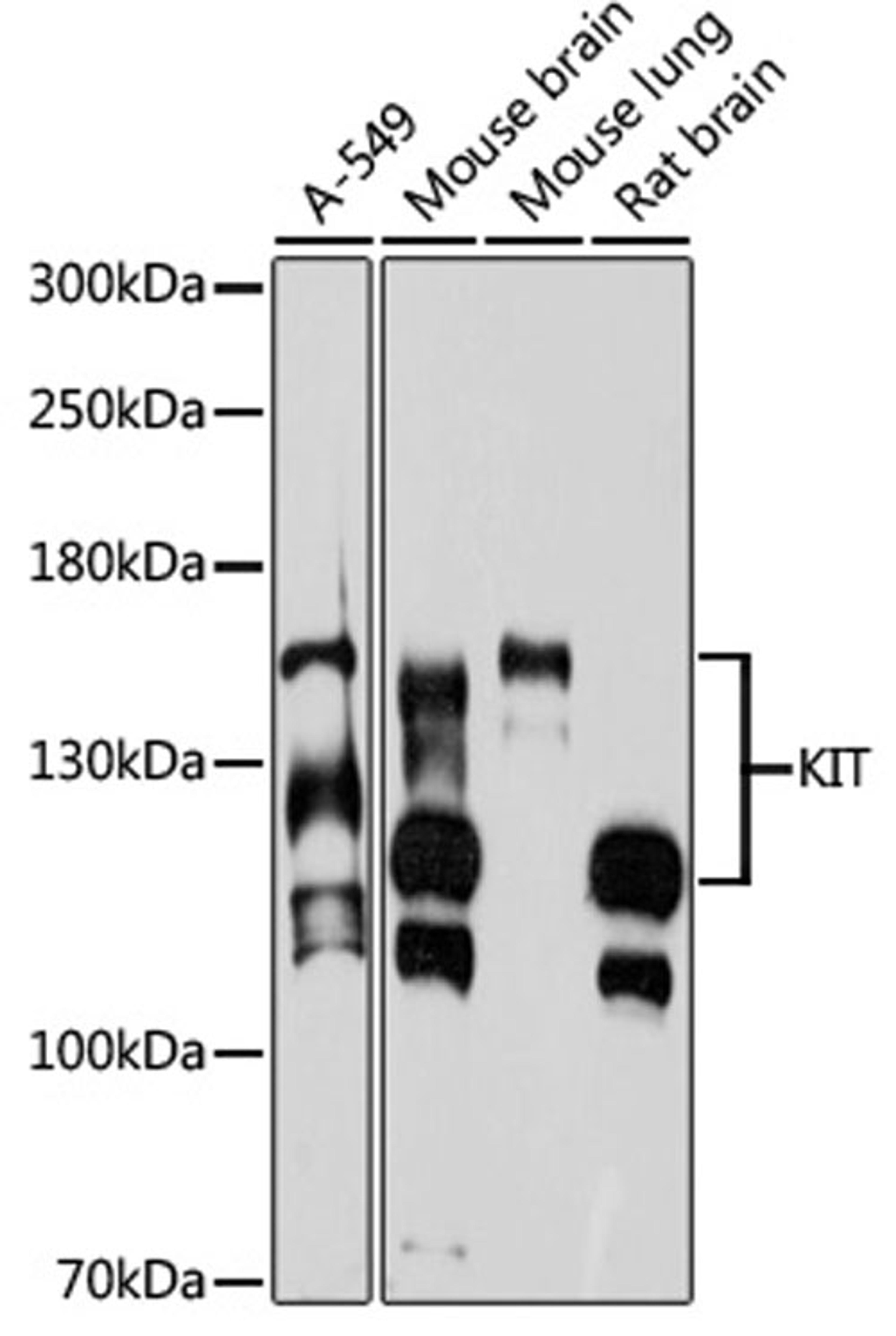 Western blot - KIT antibody (A0357)