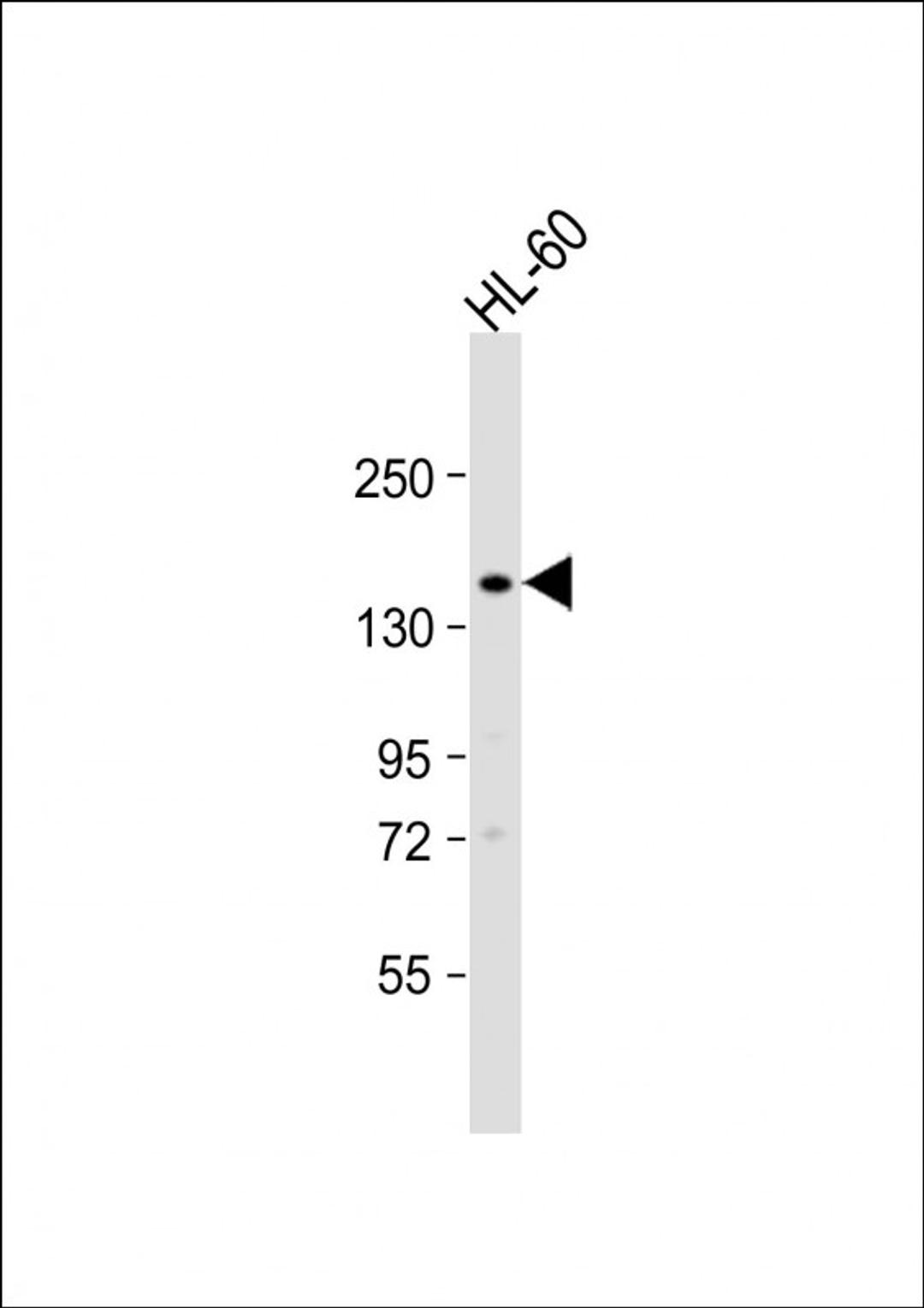 Western Blot at 1:1000 dilution + HL-60 whole cell lysate Lysates/proteins at 20 ug per lane.