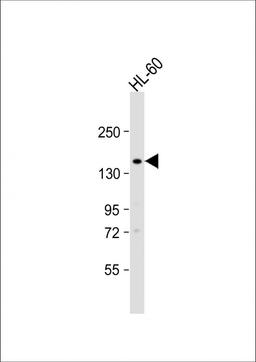 Western Blot at 1:1000 dilution + HL-60 whole cell lysate Lysates/proteins at 20 ug per lane.