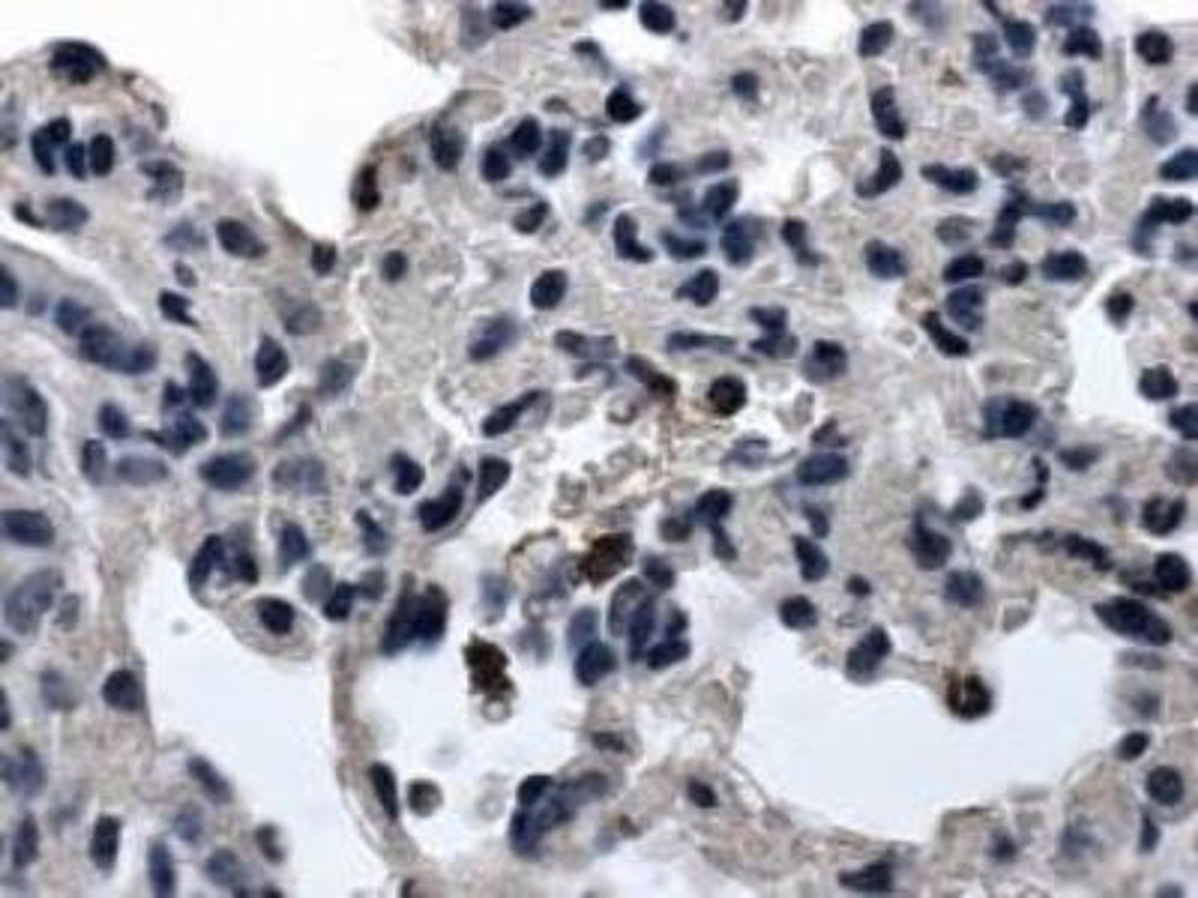 Immunohistochemistry-Paraffin: Integrin alpha E/CD103 Antibody (RM0065-7A3) [NBP2-12139] - Mouse kidney and liver tissues.