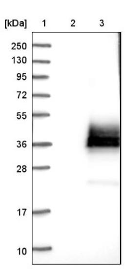 Western Blot: SPINT2 Antibody [NBP1-83299] - Lane 1: Marker [kDa] 250, 130, 95, 72, 55, 36, 28, 17, 10<br/>Lane 2: Negative control (vector only transfected HEK293T lysate)<br/>Lane 3: Over-expression lysate (Co-expressed with a C-terminal myc-DDK tag (~3.1 kDa) in mammalian HEK293T cells, LY412085)