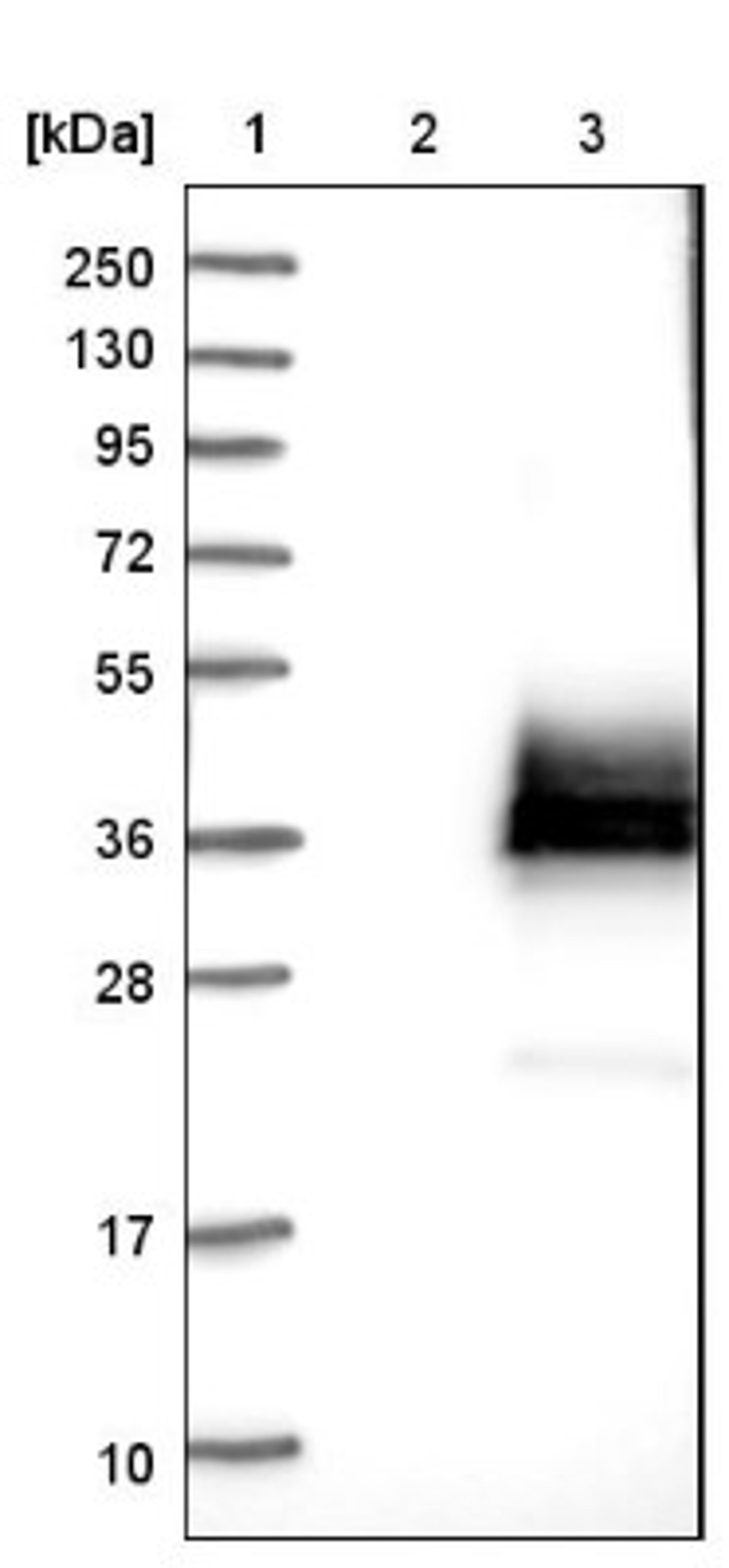 Western Blot: SPINT2 Antibody [NBP1-83299] - Lane 1: Marker [kDa] 250, 130, 95, 72, 55, 36, 28, 17, 10<br/>Lane 2: Negative control (vector only transfected HEK293T lysate)<br/>Lane 3: Over-expression lysate (Co-expressed with a C-terminal myc-DDK tag (~3.1 kDa) in mammalian HEK293T cells, LY412085)