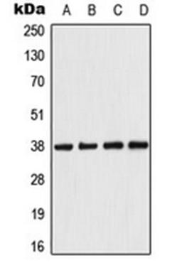 Western blot analysis of HeLa (Lane 1), Raw264.7 (Lane 2), PC12 (Lane 3), rat kidney (Lane 4) whole cell lysates using PRKAB1 antibody