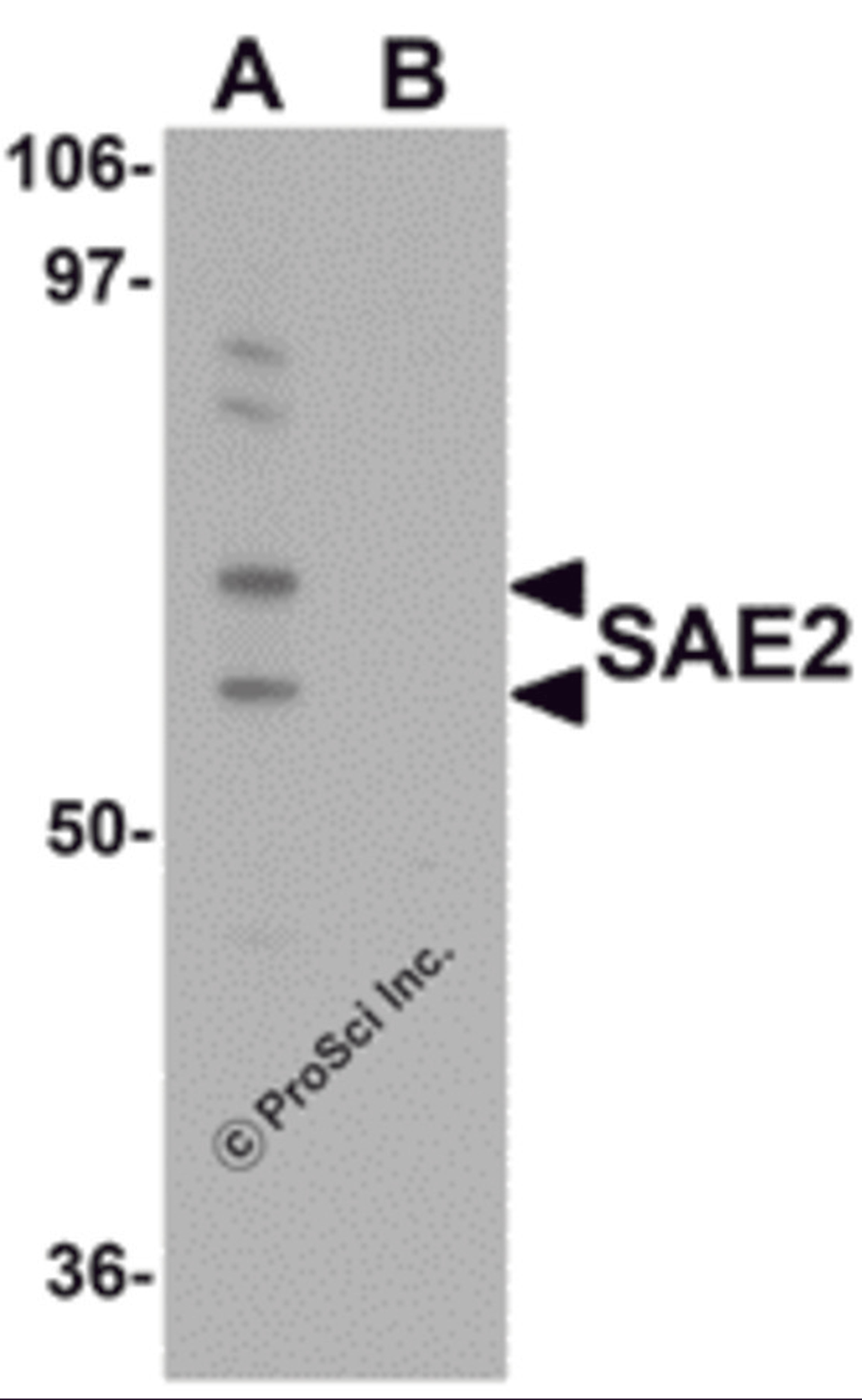 Western blot analysis of SAE2 in 293 cell lysate with SAE2 antibody at 0.25 &#956;g/mL in (A) the absence and (B) the presence of blocking peptide.