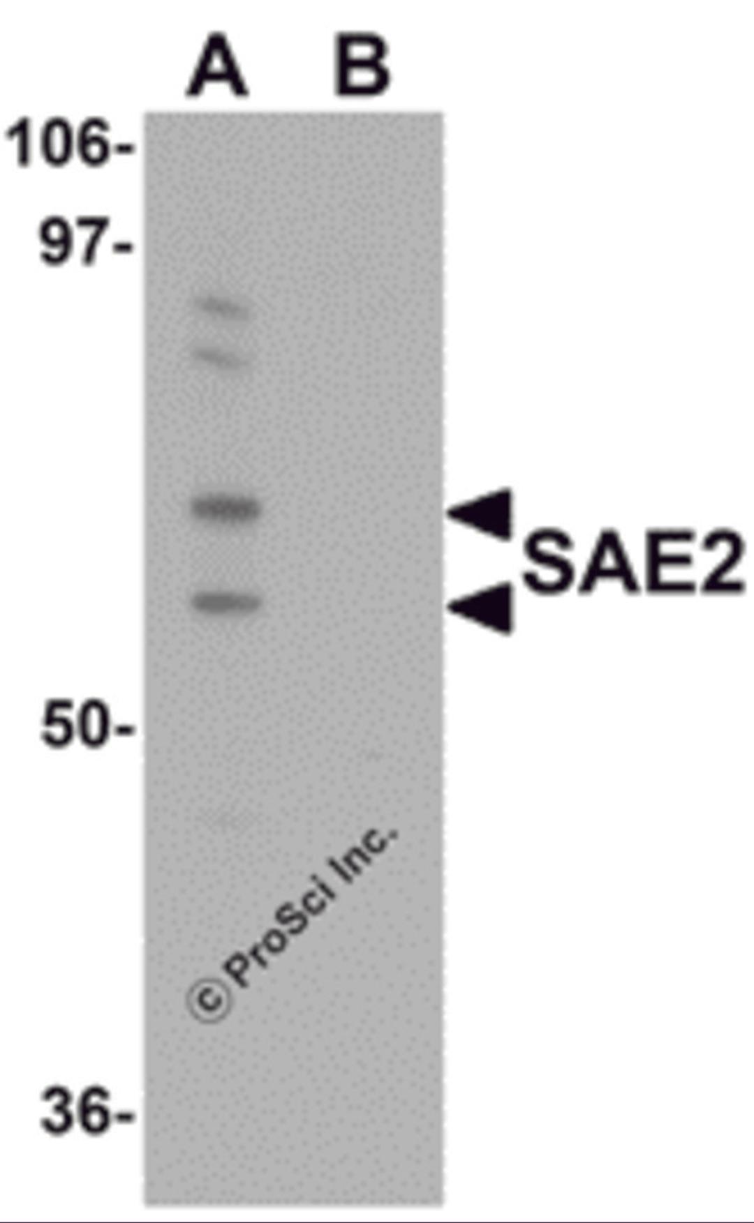 Western blot analysis of SAE2 in 293 cell lysate with SAE2 antibody at 0.25 μg/mL in (A) the absence and (B) the presence of blocking peptide.