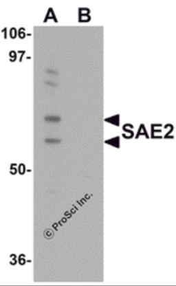 Western blot analysis of SAE2 in 293 cell lysate with SAE2 antibody at 0.25 μg/mL in (A) the absence and (B) the presence of blocking peptide.