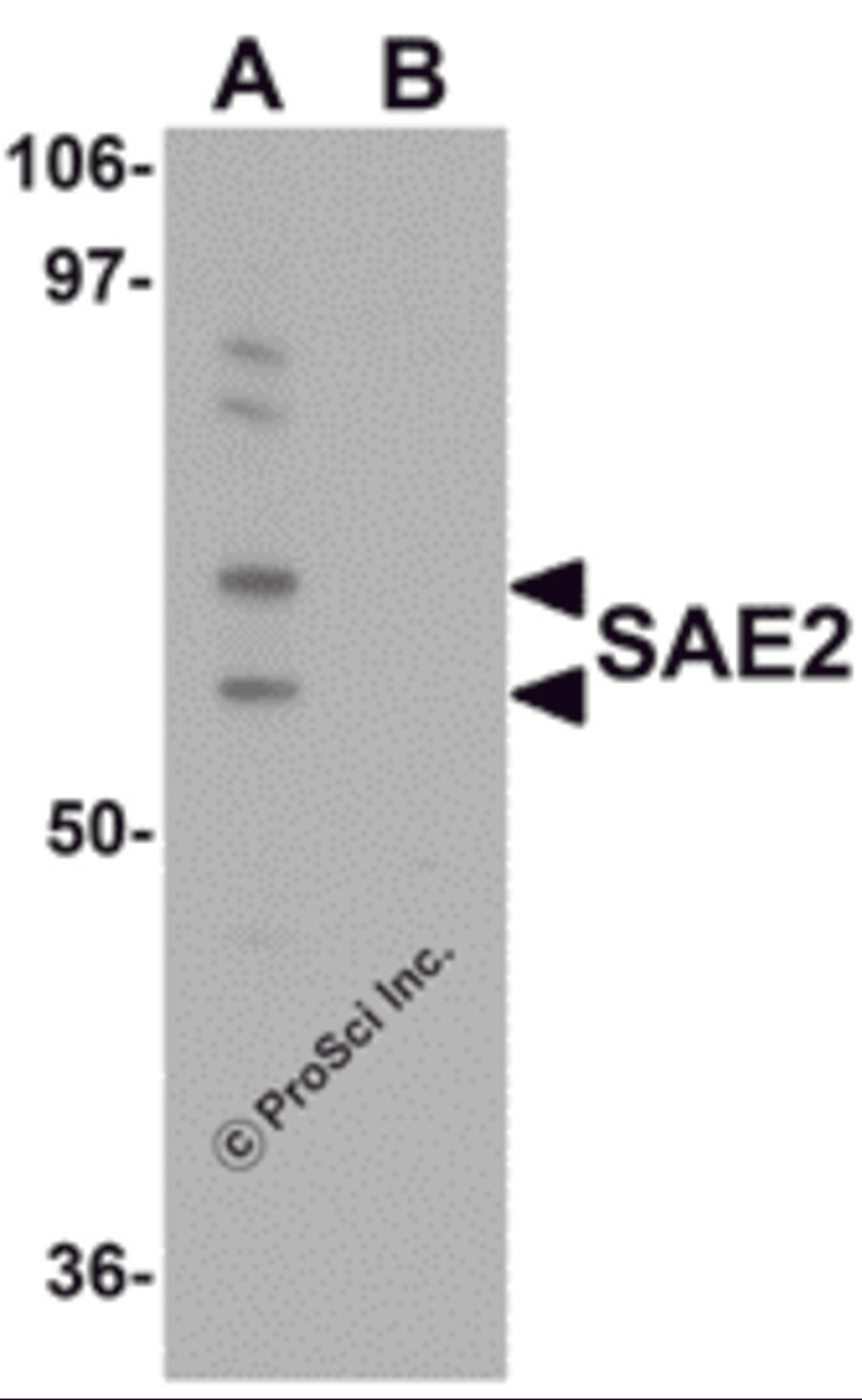 Western blot analysis of SAE2 in 293 cell lysate with SAE2 antibody at 0.25 μg/mL in (A) the absence and (B) the presence of blocking peptide.