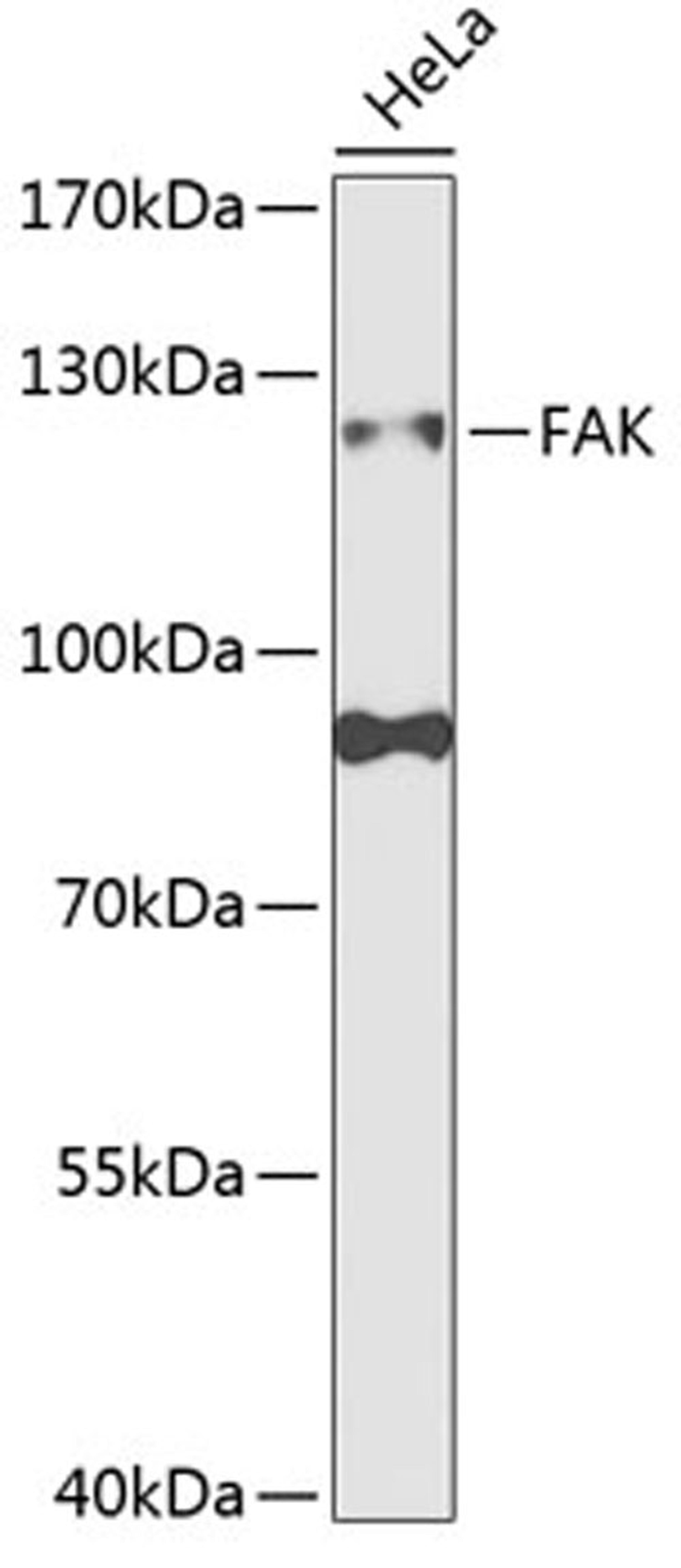 Western blot - FAK antibody (A2114)