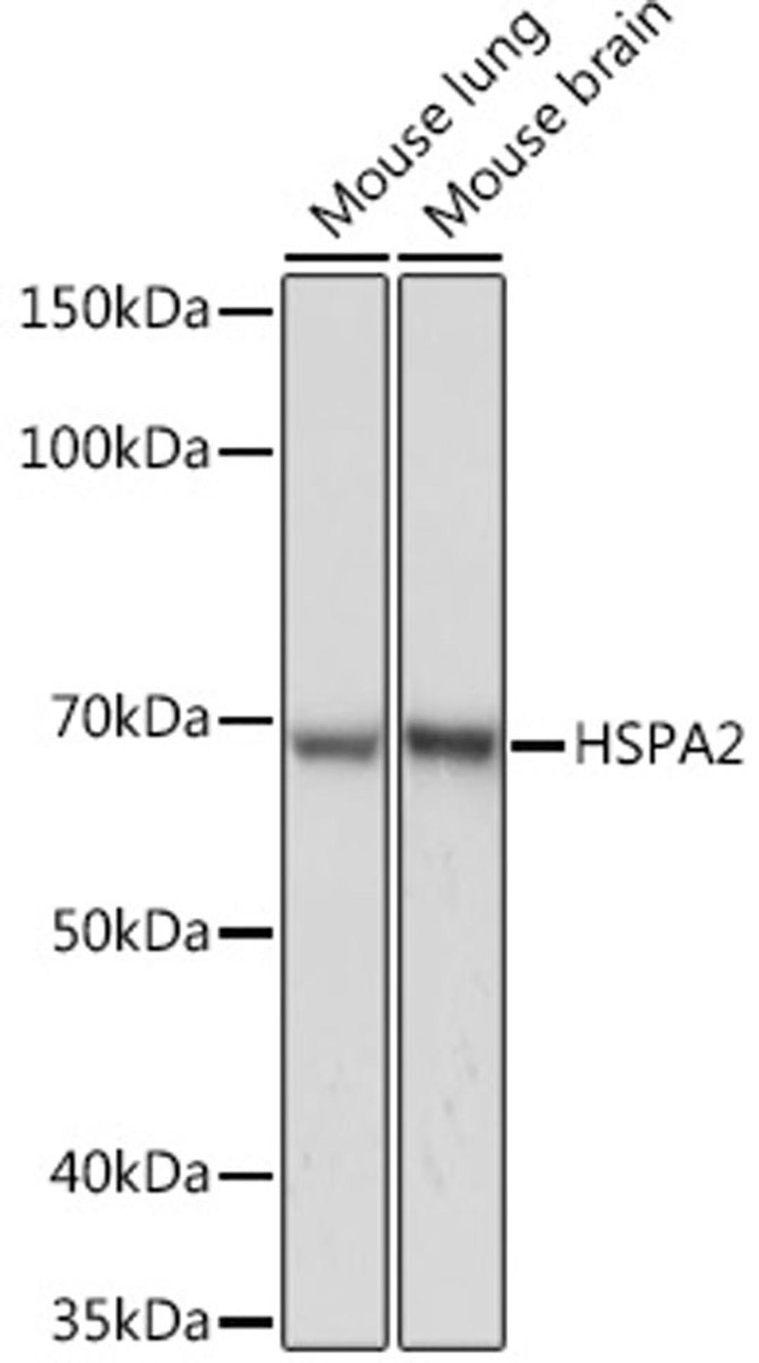 Western blot - HSPA2 Rabbit mAb (A6652)