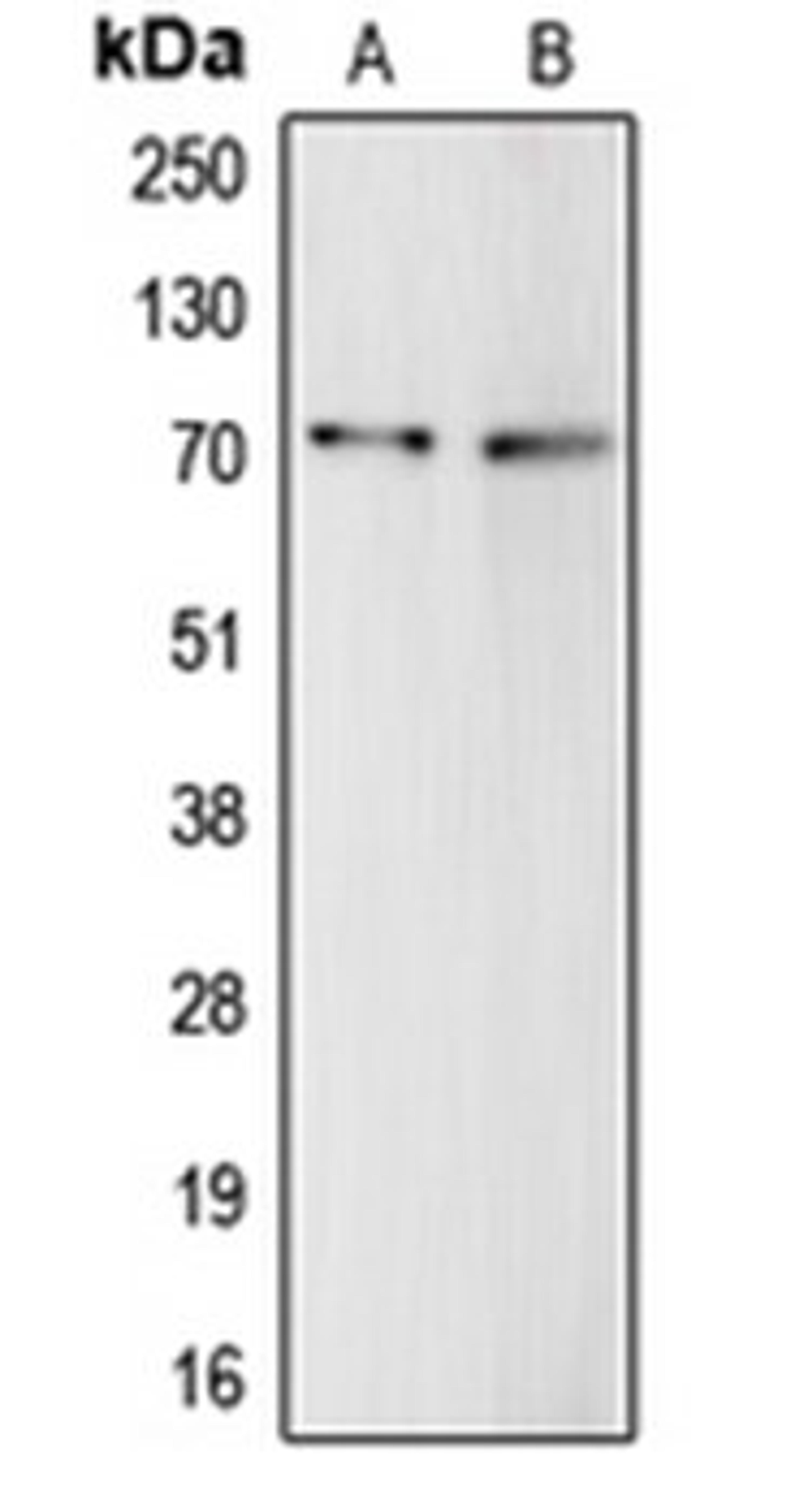 Western blot analysis of HepG2 (Lane 1), THP1 (Lane 2) whole cell lysates using C9 antibody