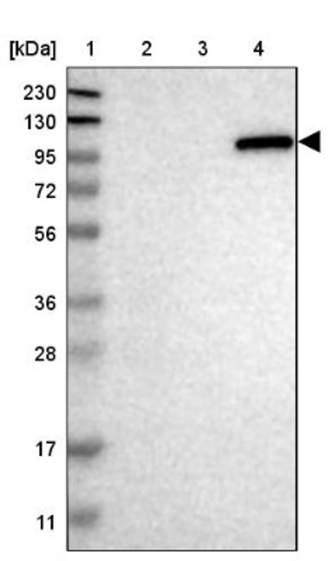 Western Blot: UNC45B Antibody [NBP1-84426] - Lane 1: Marker [kDa] 230, 130, 95, 72, 56, 36, 28, 17, 11<br/>Lane 2: Human cell line RT-4<br/>Lane 3: Human cell line U-251MG sp<br/>Lane 4: Human plasma (IgG/HSA depleted)