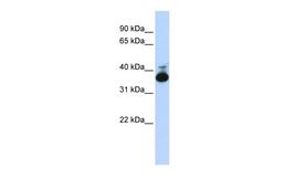 Antibody used in WB on Human Liver at 0.2-1 ug/ml.