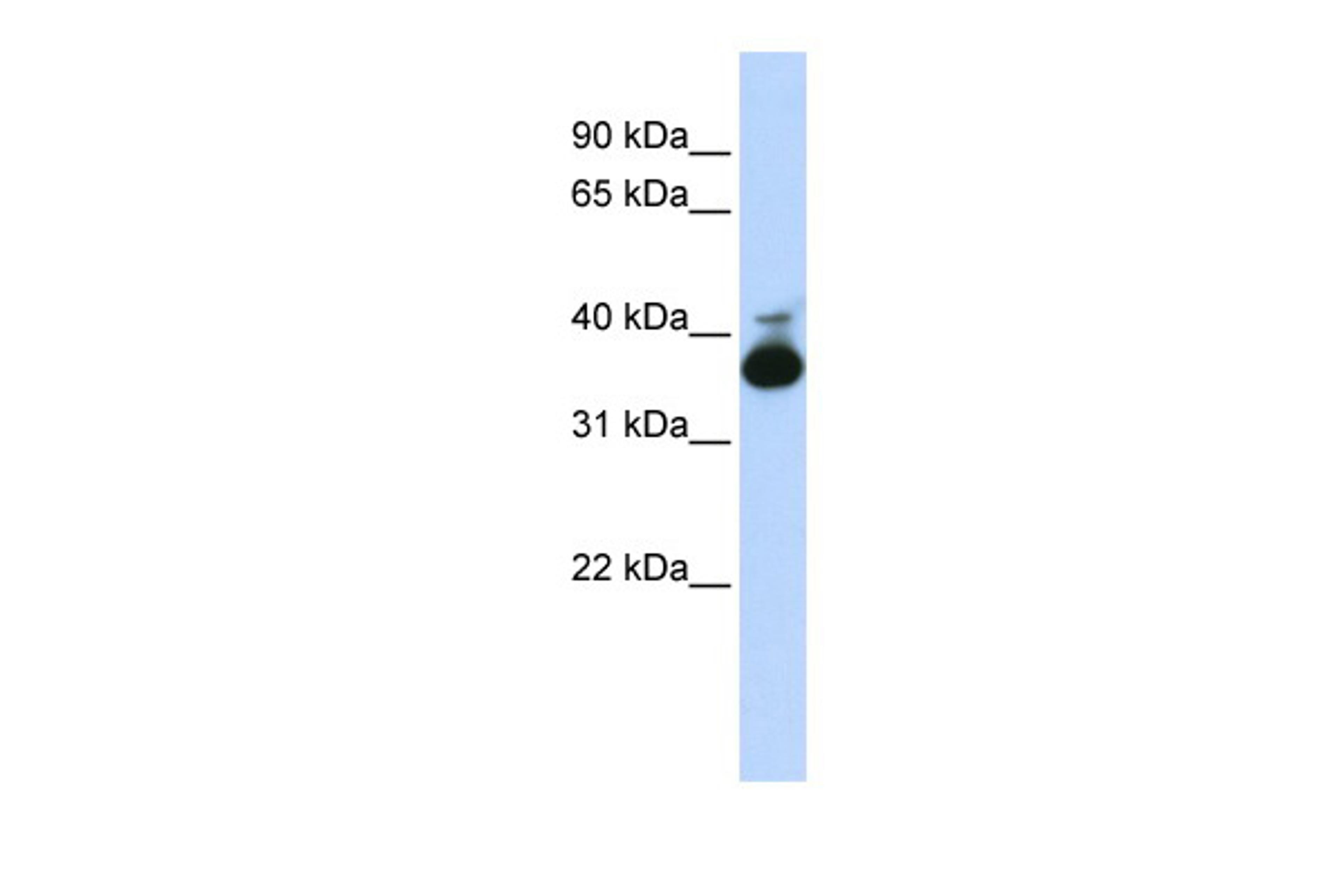 Antibody used in WB on Human Liver at 0.2-1 ug/ml.