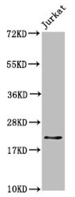 Western Blot. Positive WB detected in: Jurkat whole cell lysate. All lanes: HIST1H1C antibody at 1.7µg/ml. Secondary. Goat polyclonal to rabbit IgG at 1/50000 dilution. Predicted band size: 22 kDa. Observed band size: 22 kDa