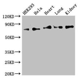 Western Blot. Positive WB detected in: HEK293 whole cell lysate, Hela whole cell lysate, Mouse heart tissue, Mouse lung tissue, Mouse kidney tissue. All lanes: FOXK1 antibody at 2.5ug/ml. Secondary. Goat polyclonal to rabbit IgG at 1/50000 dilution. Predicted band size: 76, 60 kDa. Observed band size: 76 kDa.