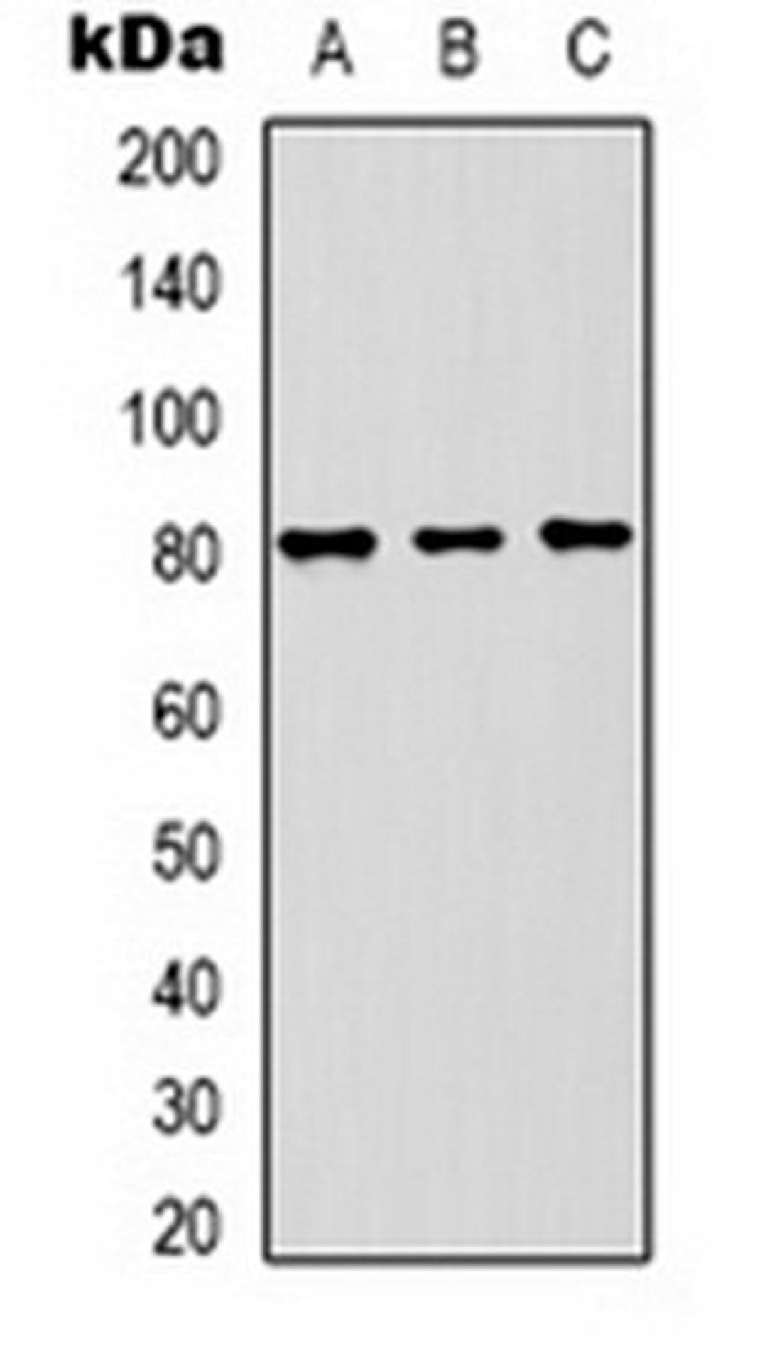 Western blot analysis of 293T (Lane 1), mouse brain (Lane 2), rat brain (Lane 3) whole cell lysates using ASIC1 antibody