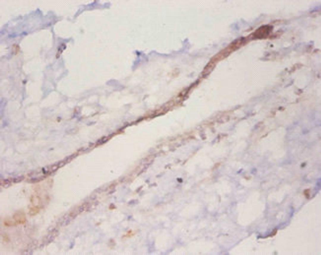 Immunohistochemistry of paraffin-embedded human mammary gland tissue using CSB-PA05864A0Rb at dilution of 1:50