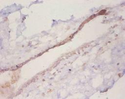Immunohistochemistry of paraffin-embedded human mammary gland tissue using CSB-PA05864A0Rb at dilution of 1:50