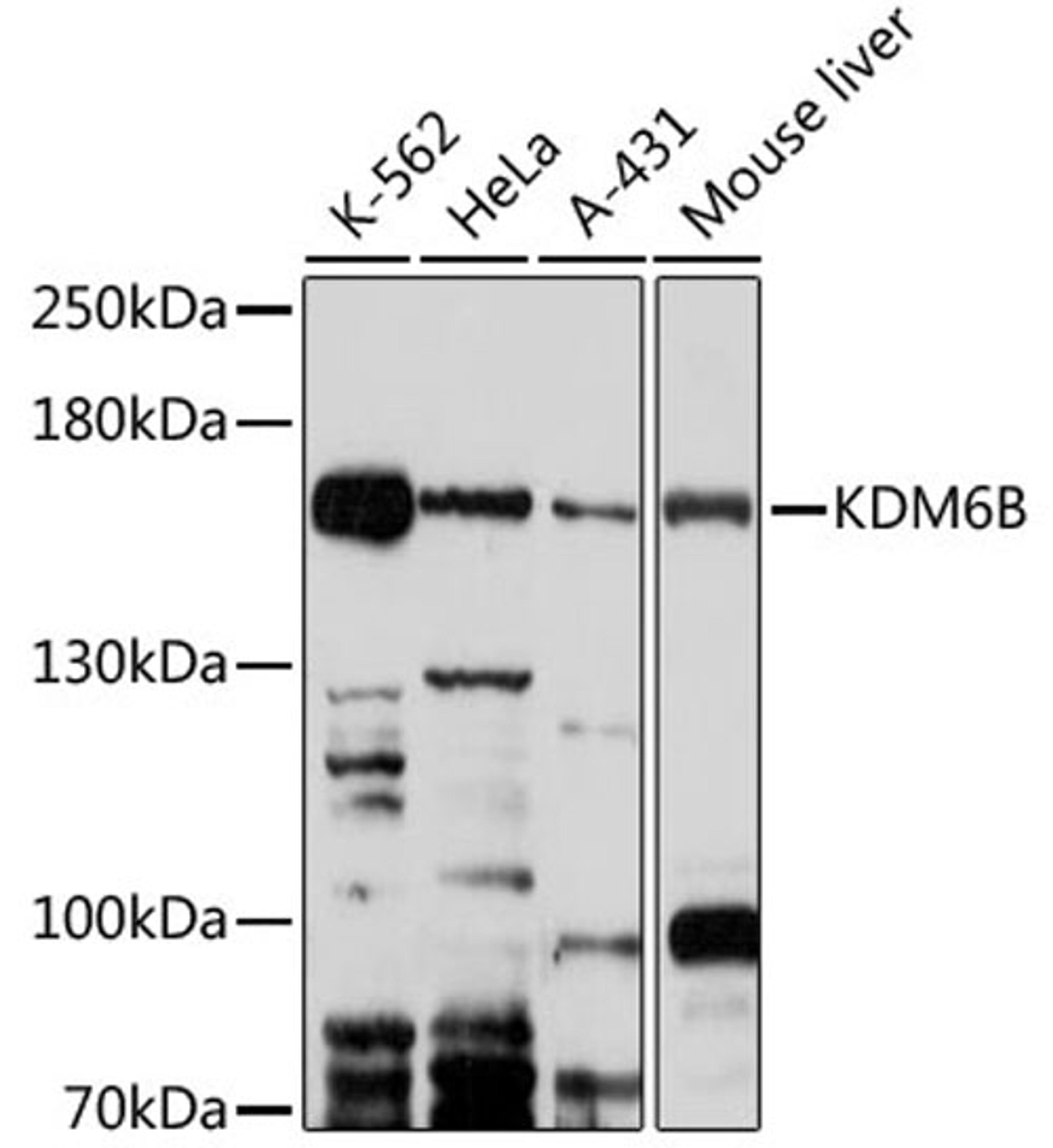 Western blot - KDM6B antibody (A17382)