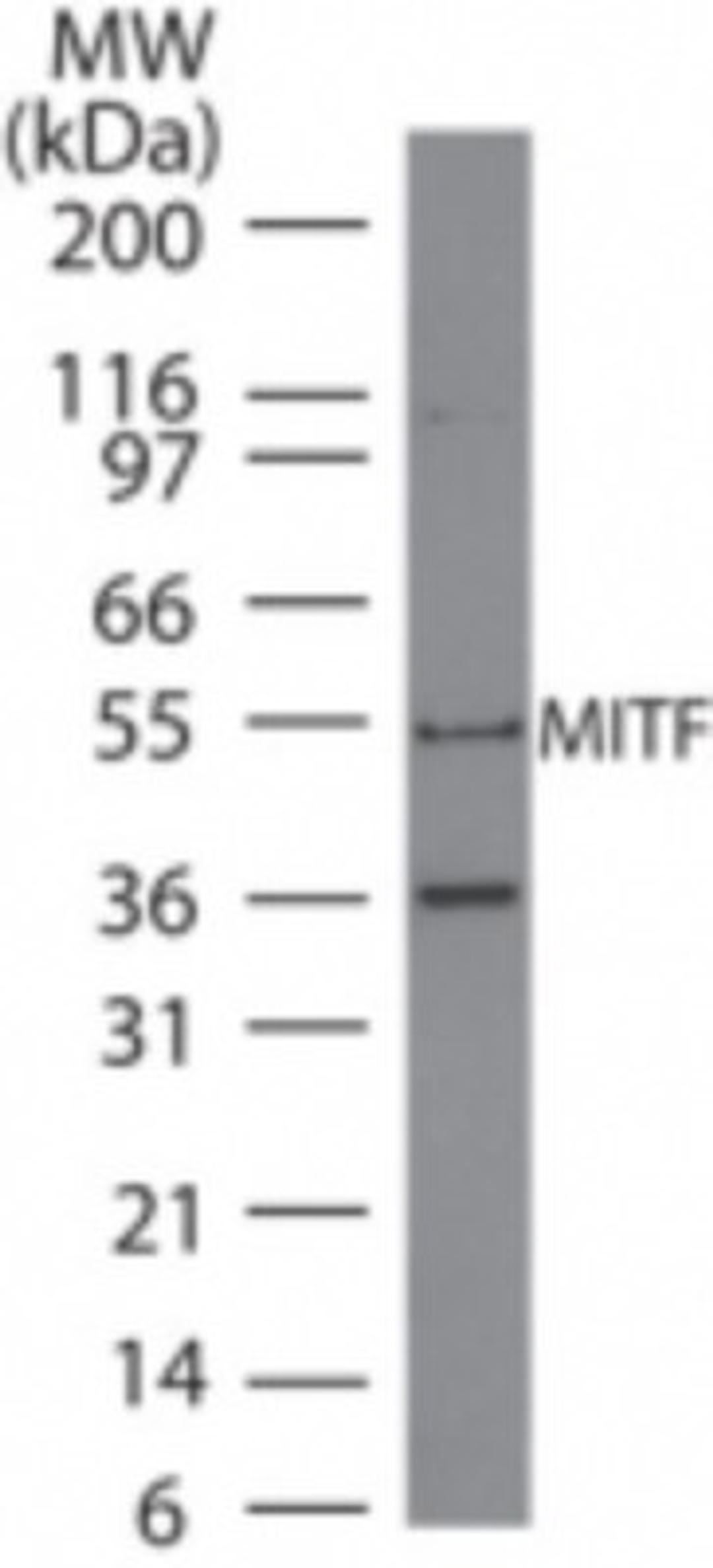 Western Blot: MiTF Antibody (21D1418) [NB100-56561] - Analysis of A375 lysate using MITF antibody at 4 ug/ml.