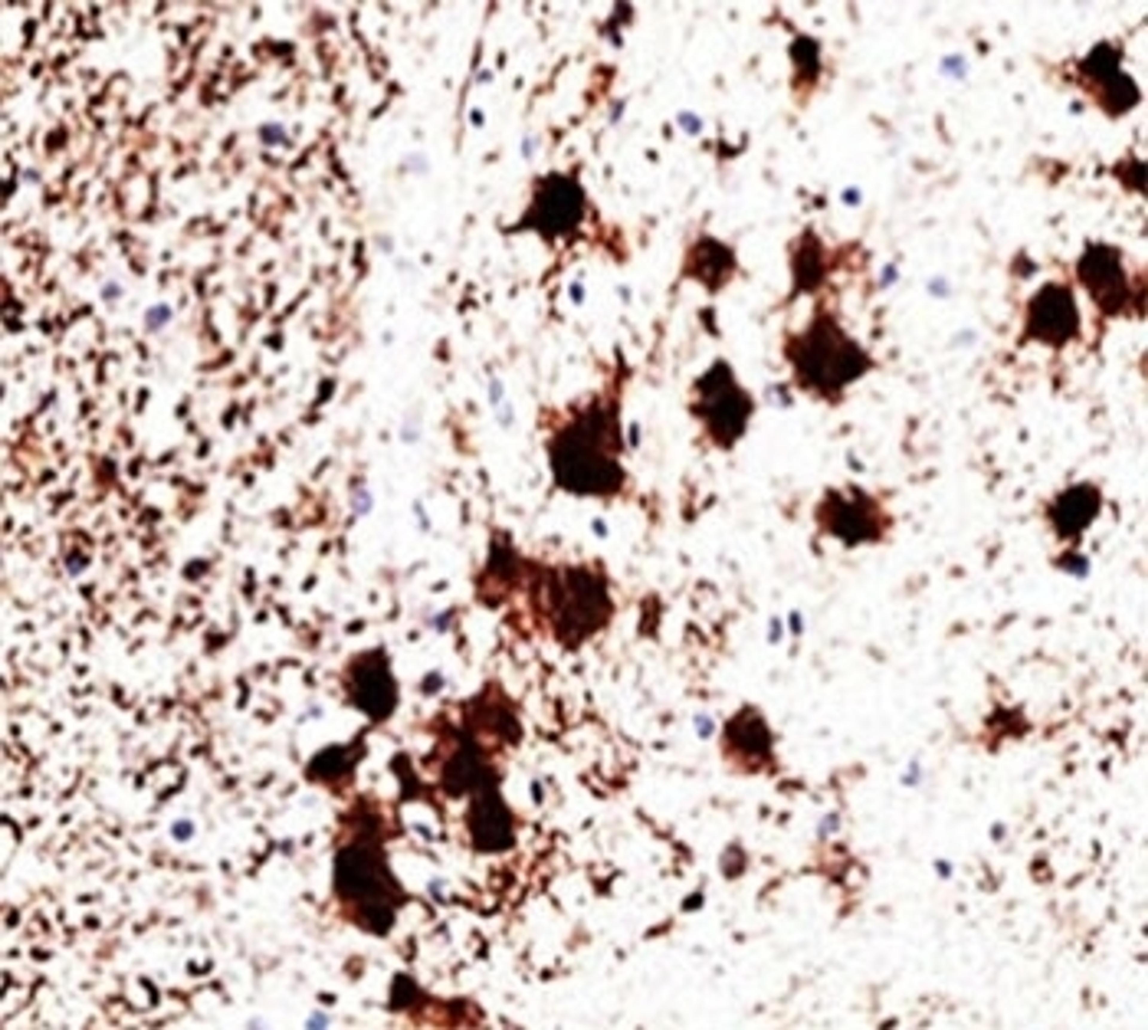 IHC staining of human brain with PGP9.5 antibody (31A3).