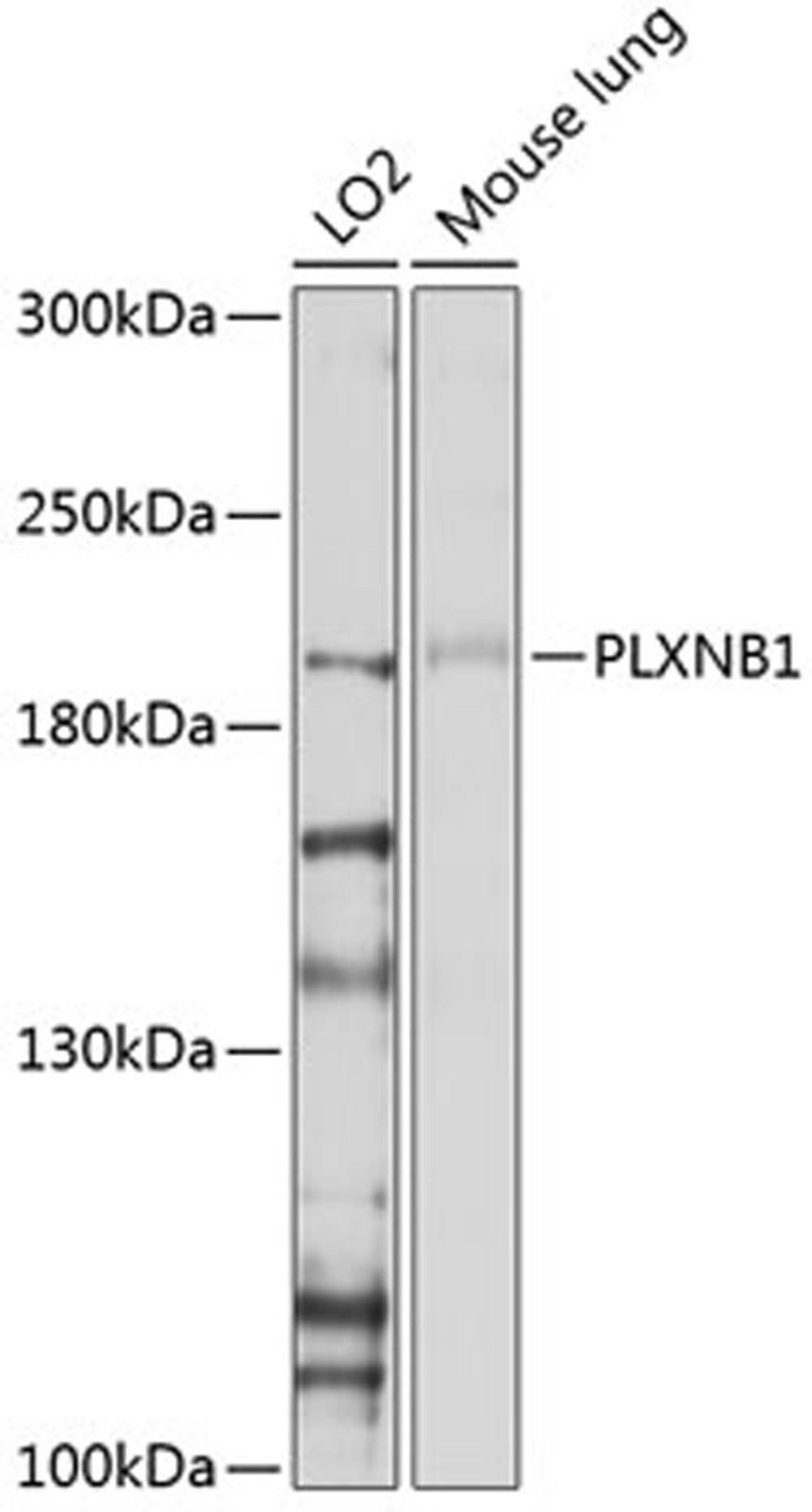 Western blot - PLXNB1 antibody (A10010)