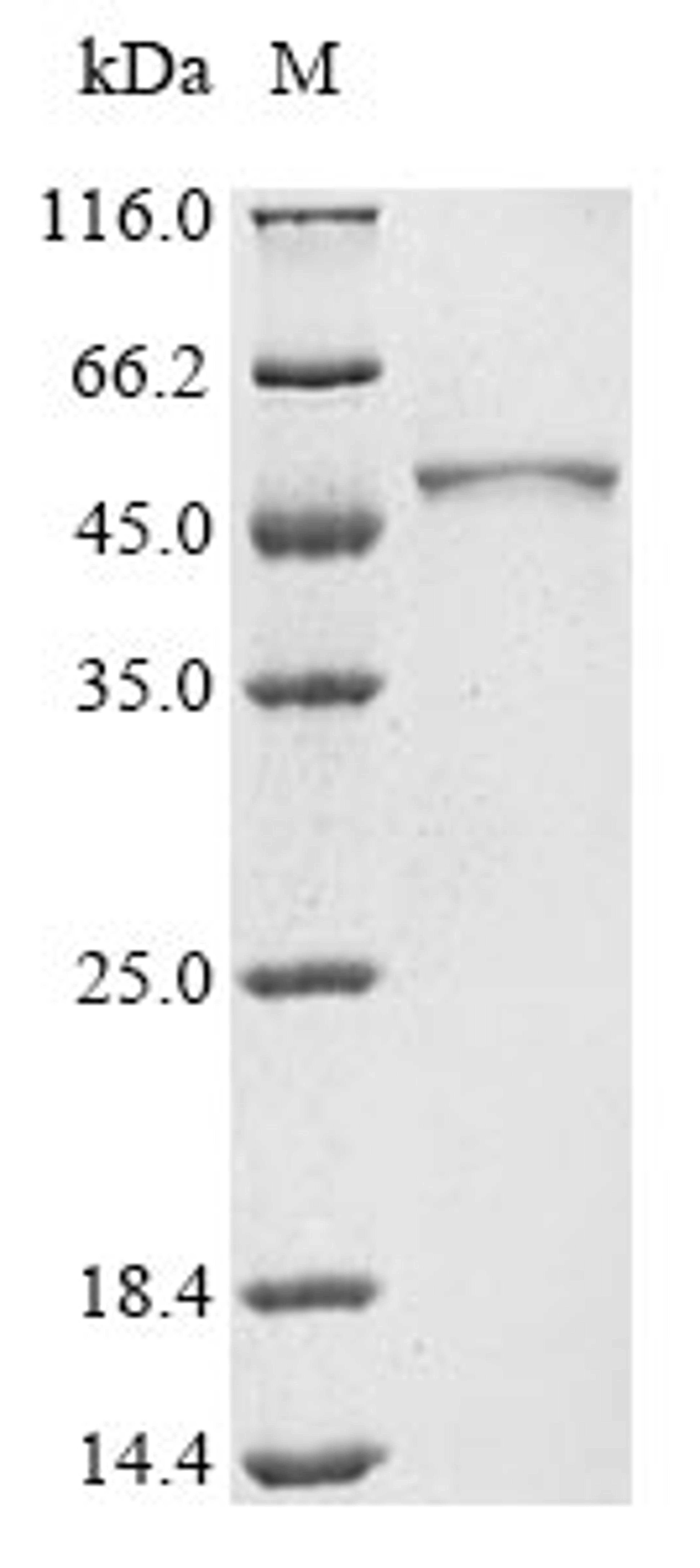 (Tris-Glycine gel) Discontinuous SDS-PAGE (reduced) with 5% enrichment gel and 15% separation gel.