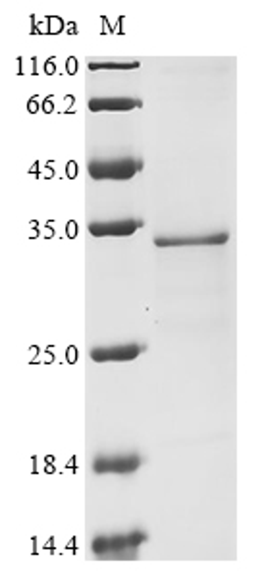 (Tris-Glycine gel) Discontinuous SDS-PAGE (reduced) with 5% enrichment gel and 15% separation gel.