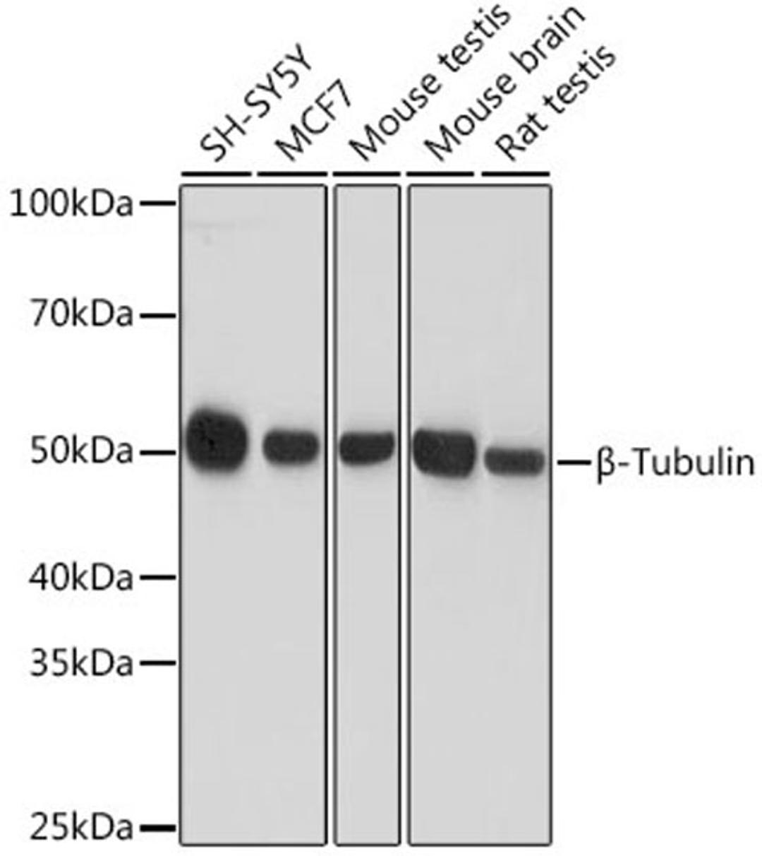 Western blot - ß-Tubulin antibody (AC008)