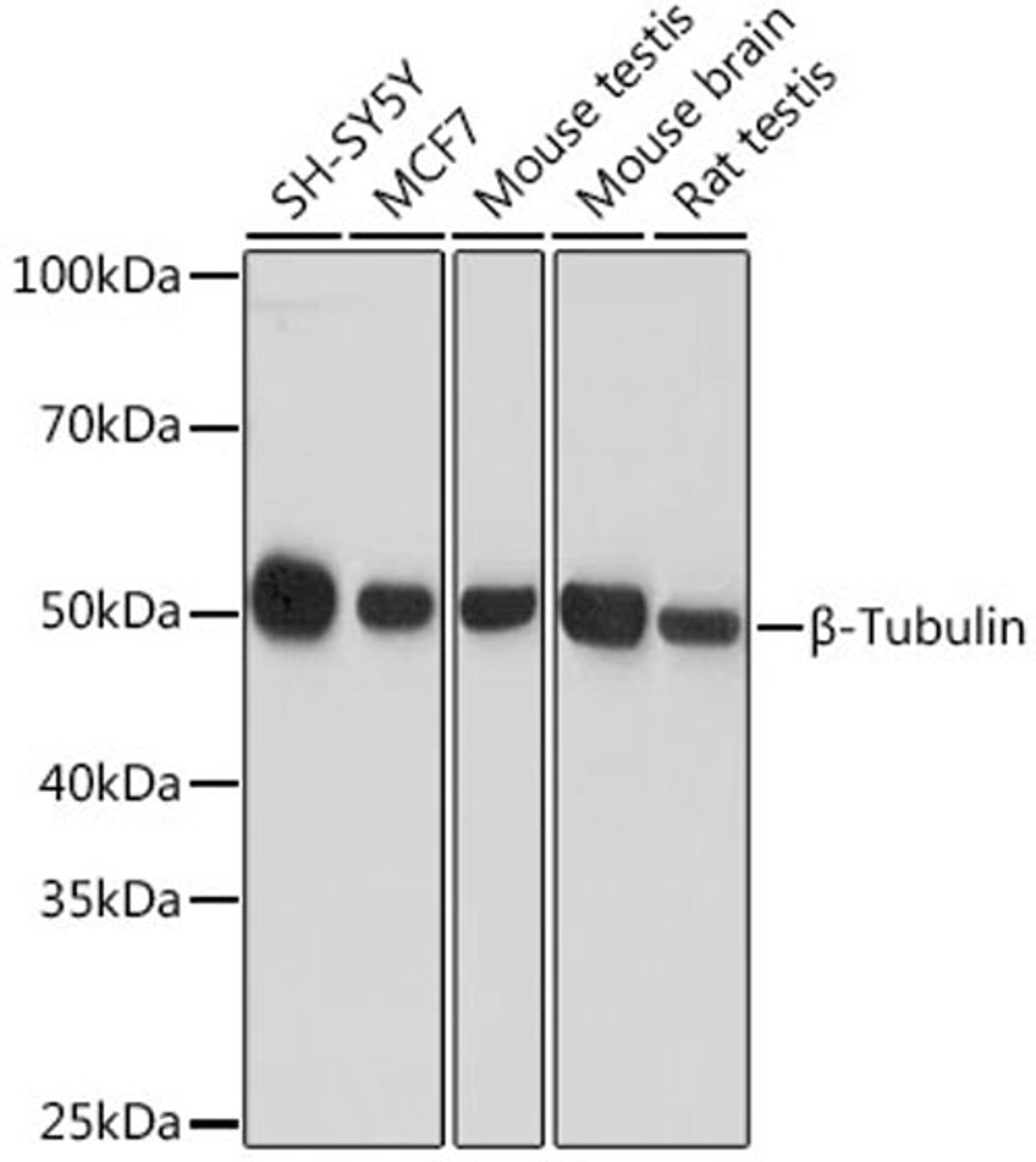 Western blot - ß-Tubulin antibody (AC008)