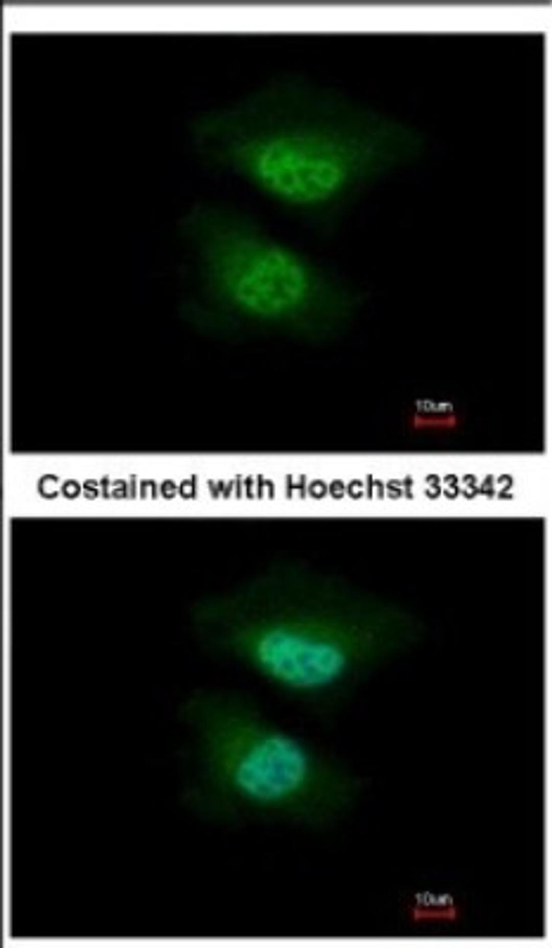 Immunocytochemistry/Immunofluorescence: Nab2 Antibody [NBP2-19462] - Immunofluorescence analysis of paraformaldehyde-fixed HeLa, using antibody at 1:500 dilution.