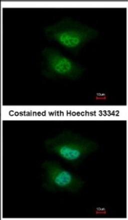 Immunocytochemistry/Immunofluorescence: Nab2 Antibody [NBP2-19462] - Immunofluorescence analysis of paraformaldehyde-fixed HeLa, using antibody at 1:500 dilution.