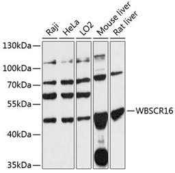 Western blot - WBSCR16 antibody (A14330)