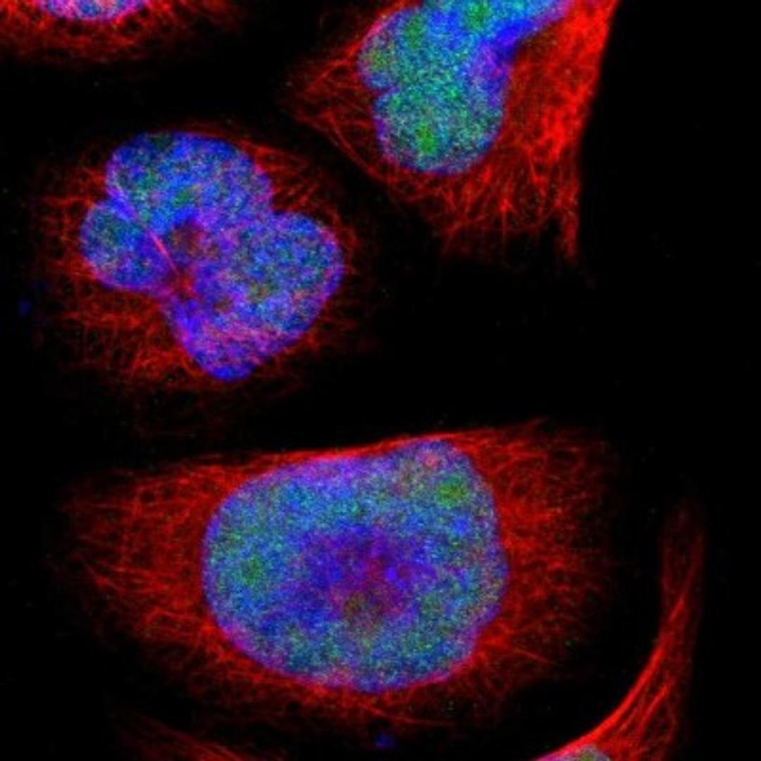 Immunocytochemistry/Immunofluorescence: UBR7 Antibody [NBP1-88409] - Staining of human cell line A-431 shows positivity in nuclei.