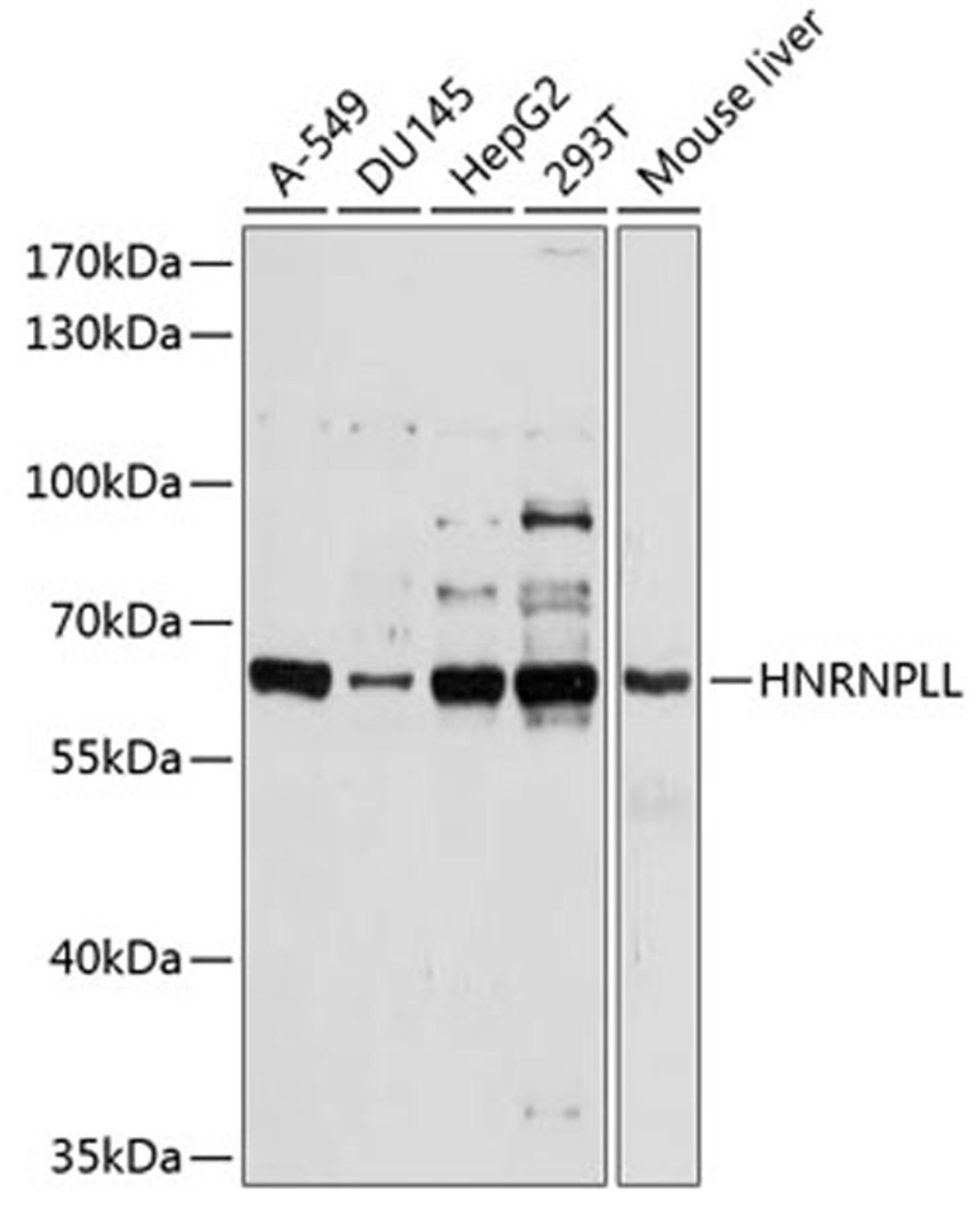 Western blot - HNRNPLL antibody (A10360)