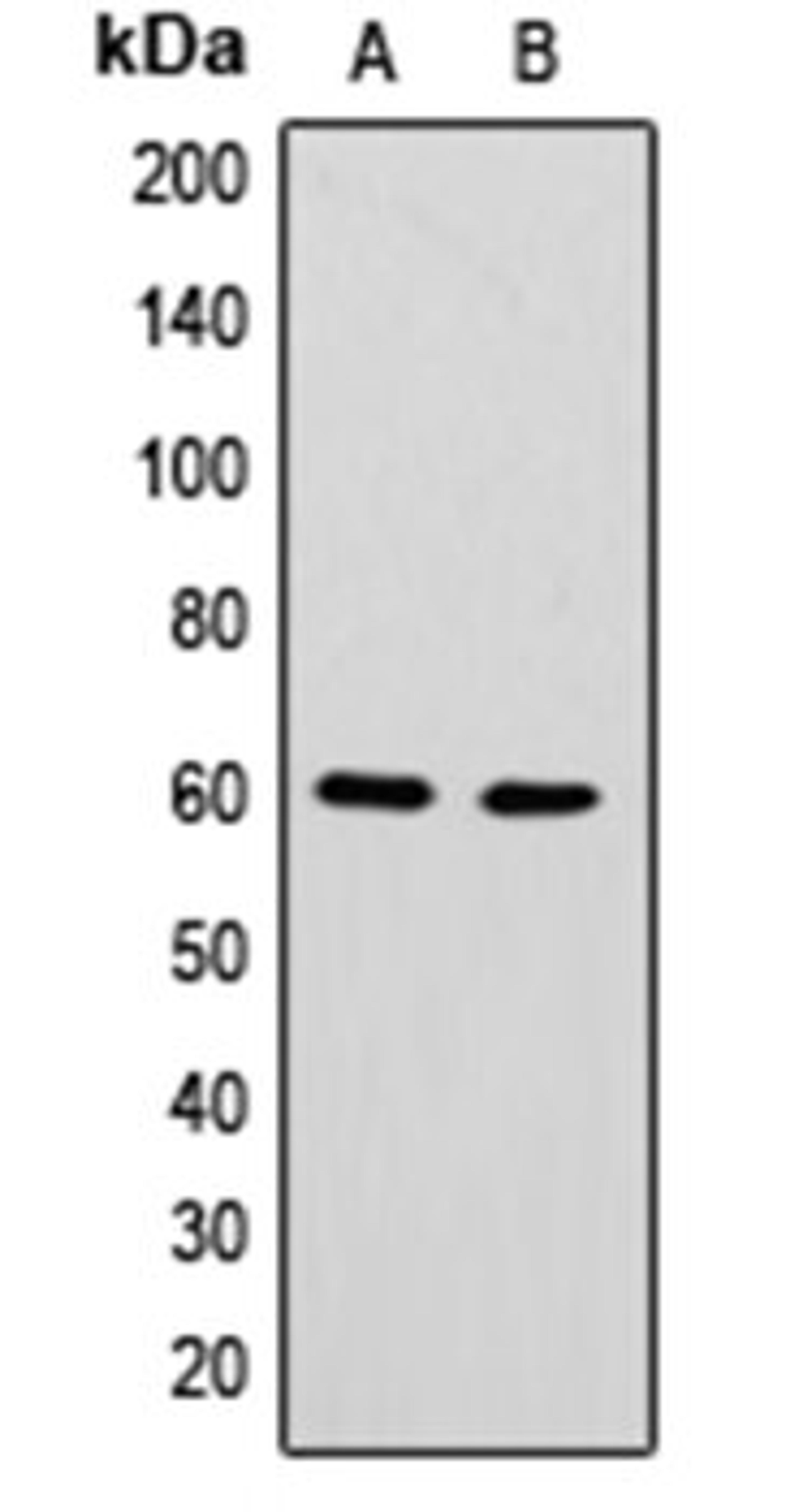 Western blot analysis of HepG2 (Lane 1), K562 (Lane 2) whole cell lysates using hnRNP LL antibody