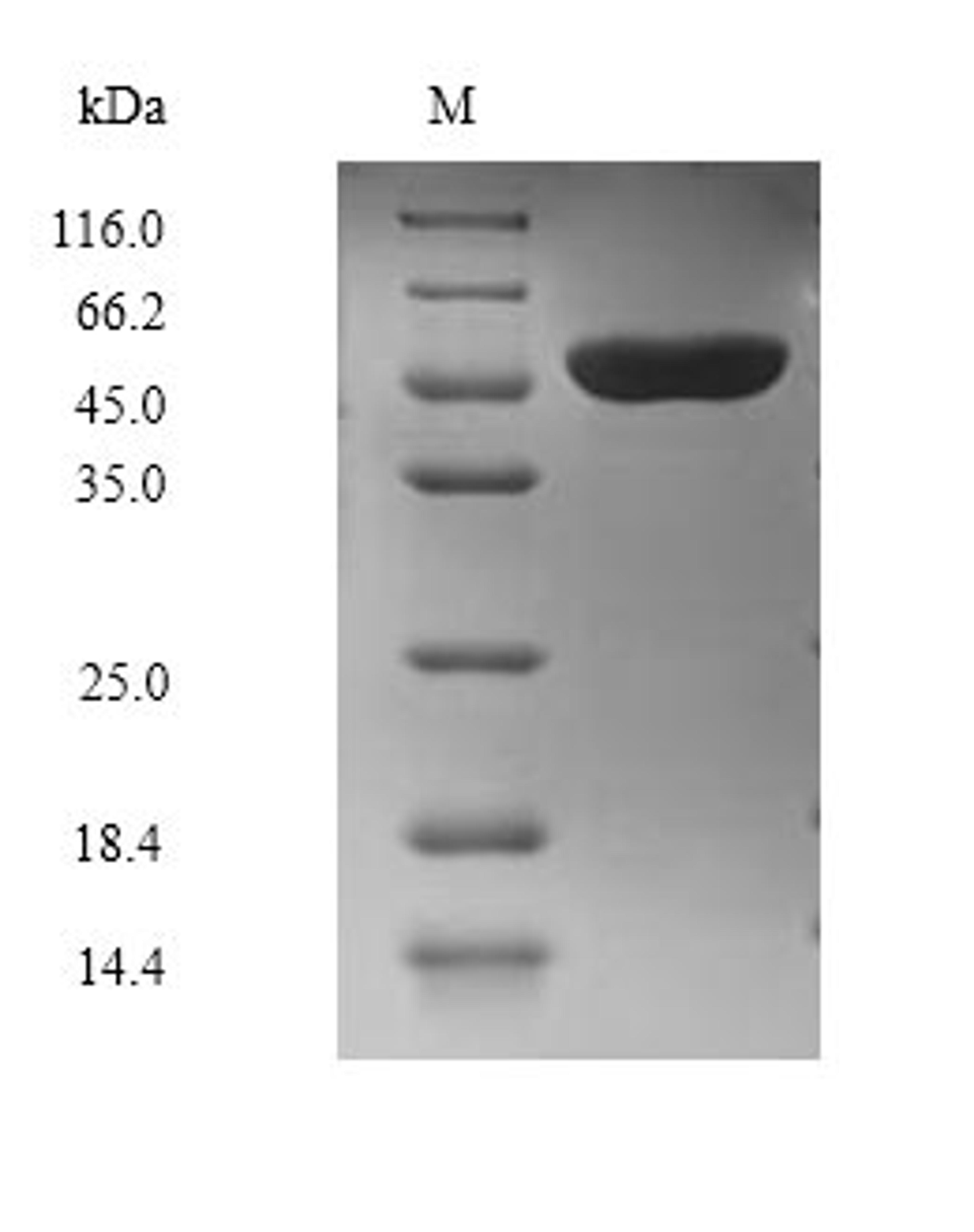 (Tris-Glycine gel) Discontinuous SDS-PAGE (reduced) with 5% enrichment gel and 15% separation gel.