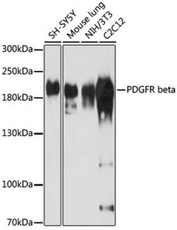 Western blot - PDGFR beta antibody (A2180)