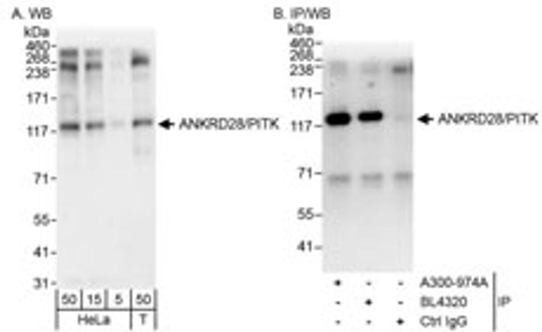 Detection of human ANKRD28/PITK by western blot and immunoprecipitation.