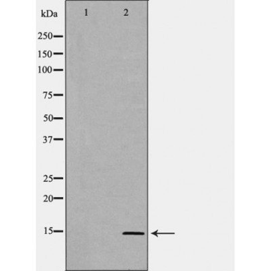 Western blot analysis of human liver cell lines using SAA1 antibody