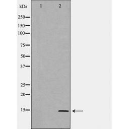 Western blot analysis of human liver cell lines using SAA1 antibody