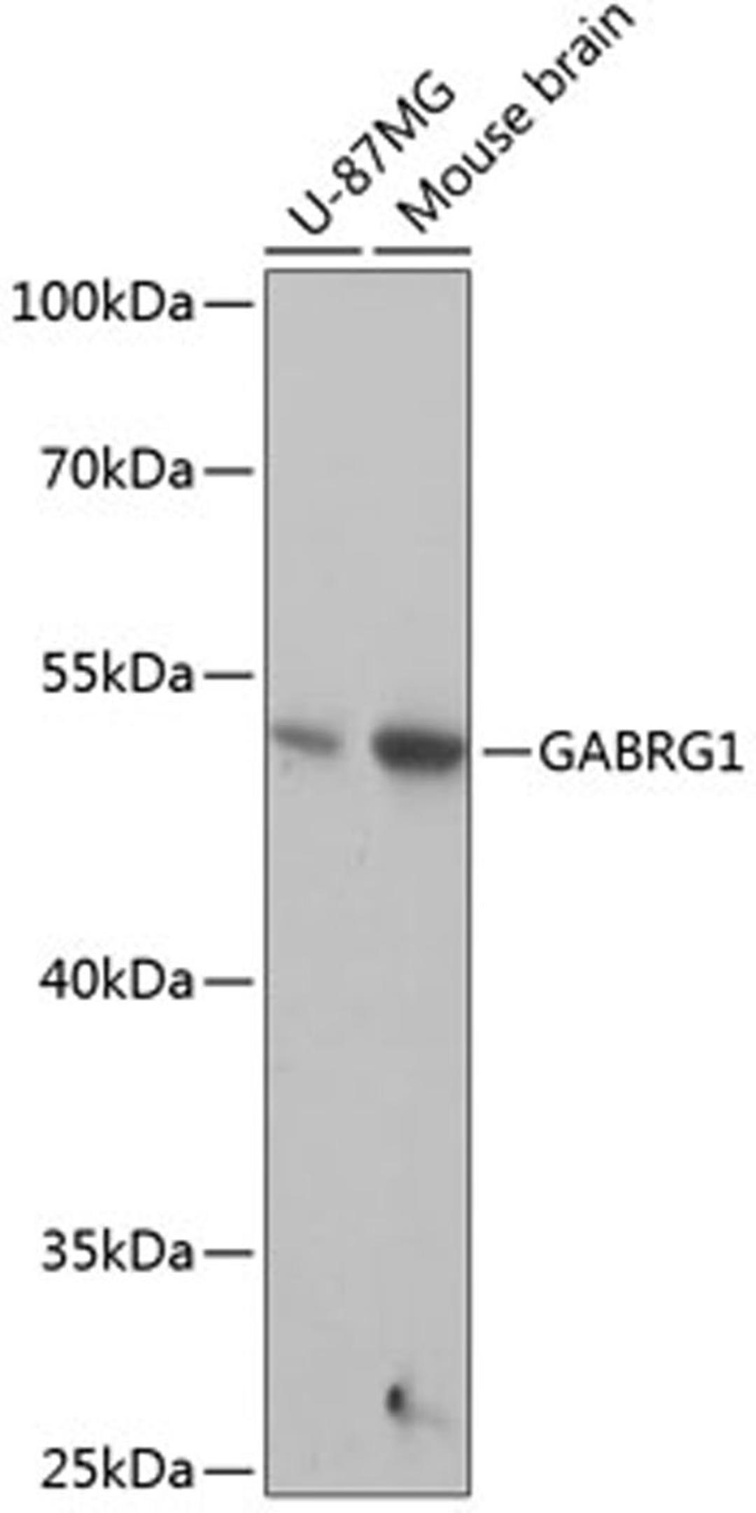 Western blot - GABRG1 antibody (A14240)