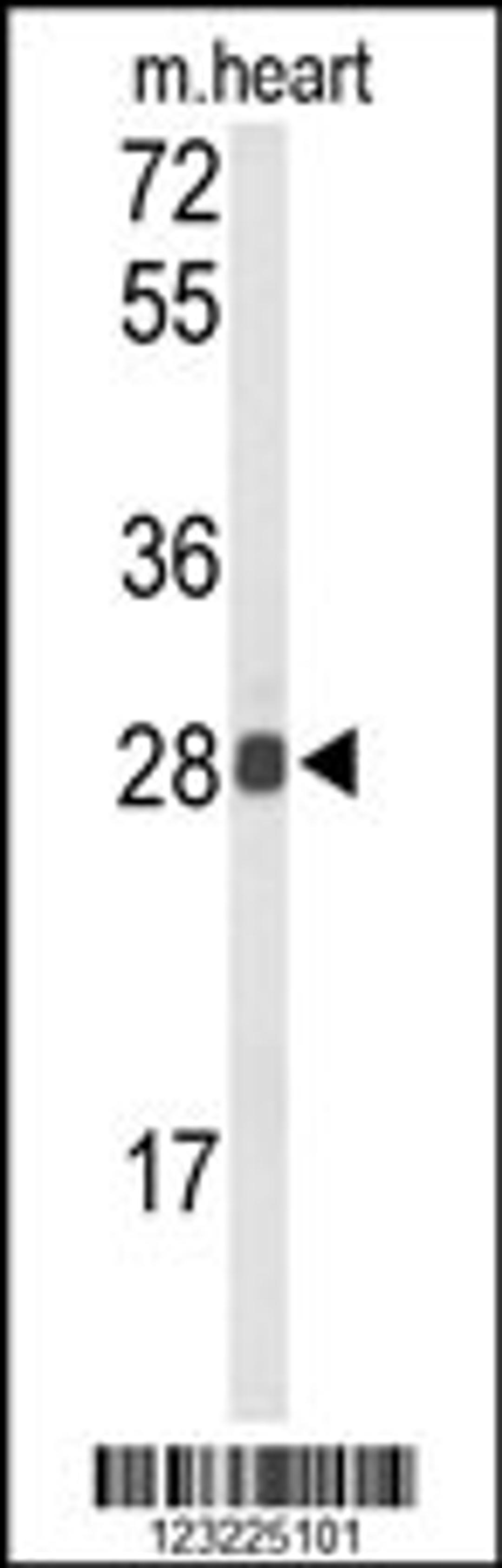 Western blot analysis of TSPAN1 Antibody in mouse heart tissue lysates (35ug/lane)