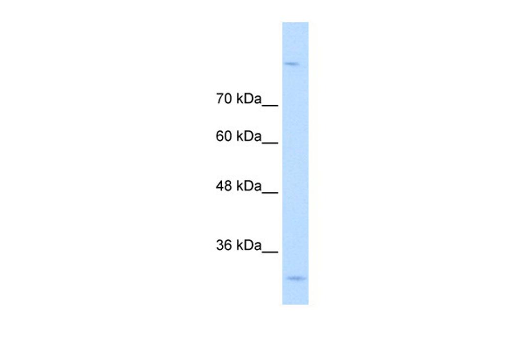 Antibody used in WB on Human A204 cells at 0.2-1 ug/ml.