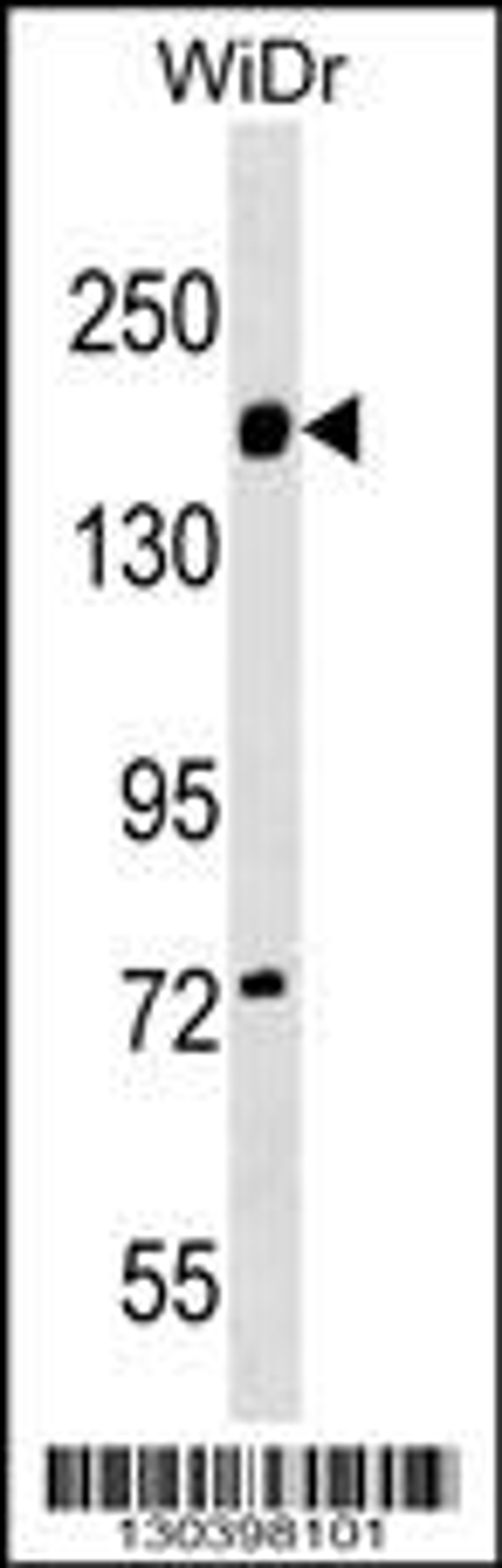 Western blot analysis in WiDr cell line lysates (35ug/lane).