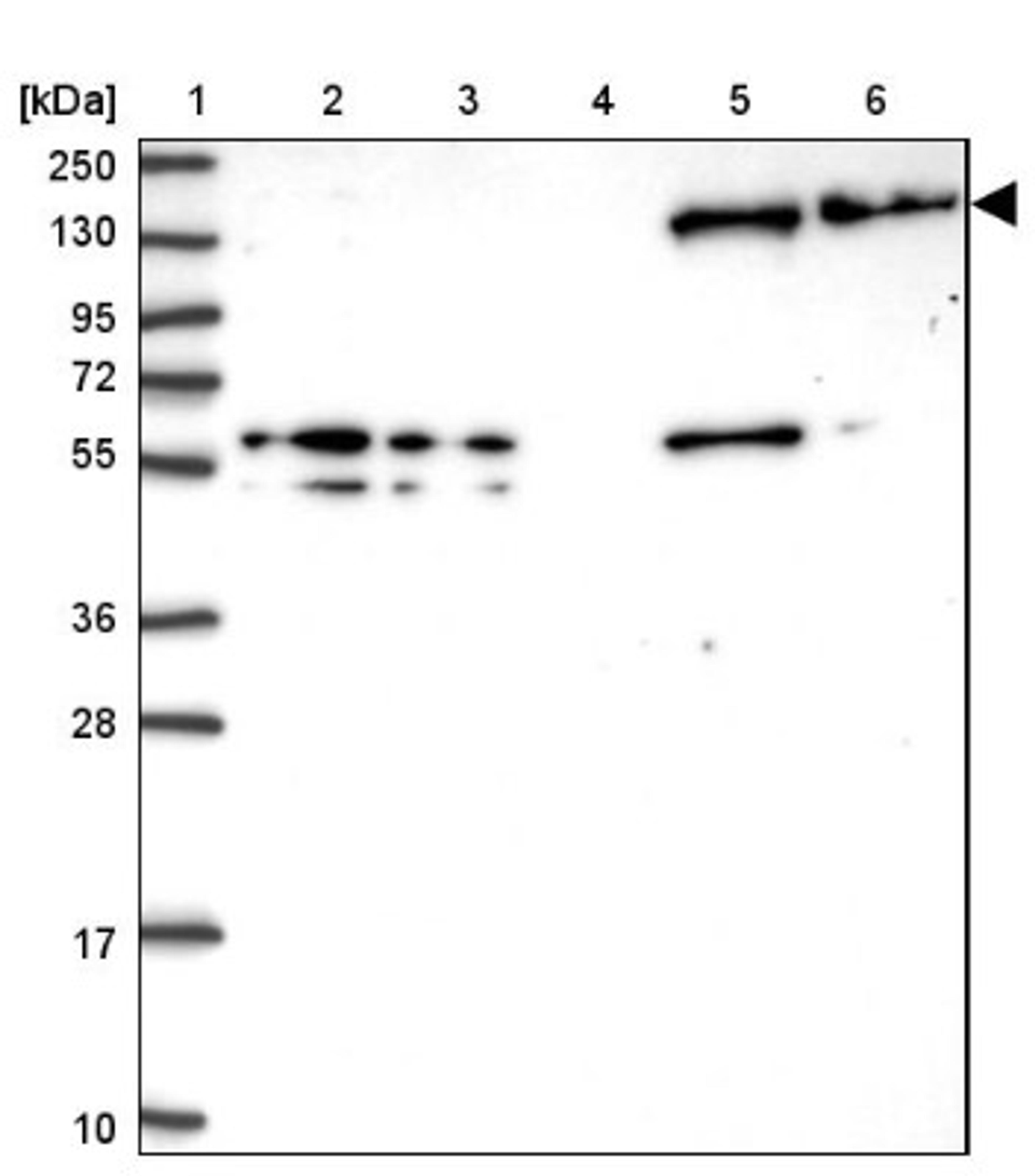 Western Blot: non-muscle heavy chain 10 Myosin Antibody [NBP2-38566] - Lane 1: Marker [kDa] 250, 130, 95, 72, 55, 36, 28, 17, 10<br/>Lane 2: RT-4<br/>Lane 3: U-251 MG<br/>Lane 4: Human Plasma<br/>Lane 5: Liver<br/>Lane 6: Tonsil