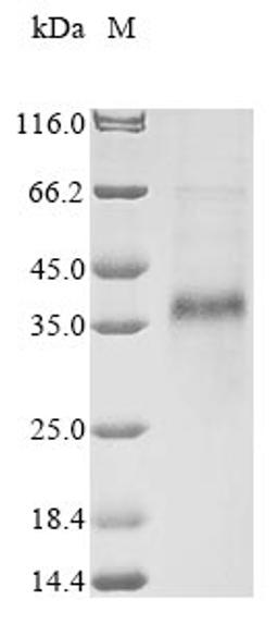 (Tris-Glycine gel) Discontinuous SDS-PAGE (reduced) with 5% enrichment gel and 15% separation gel.