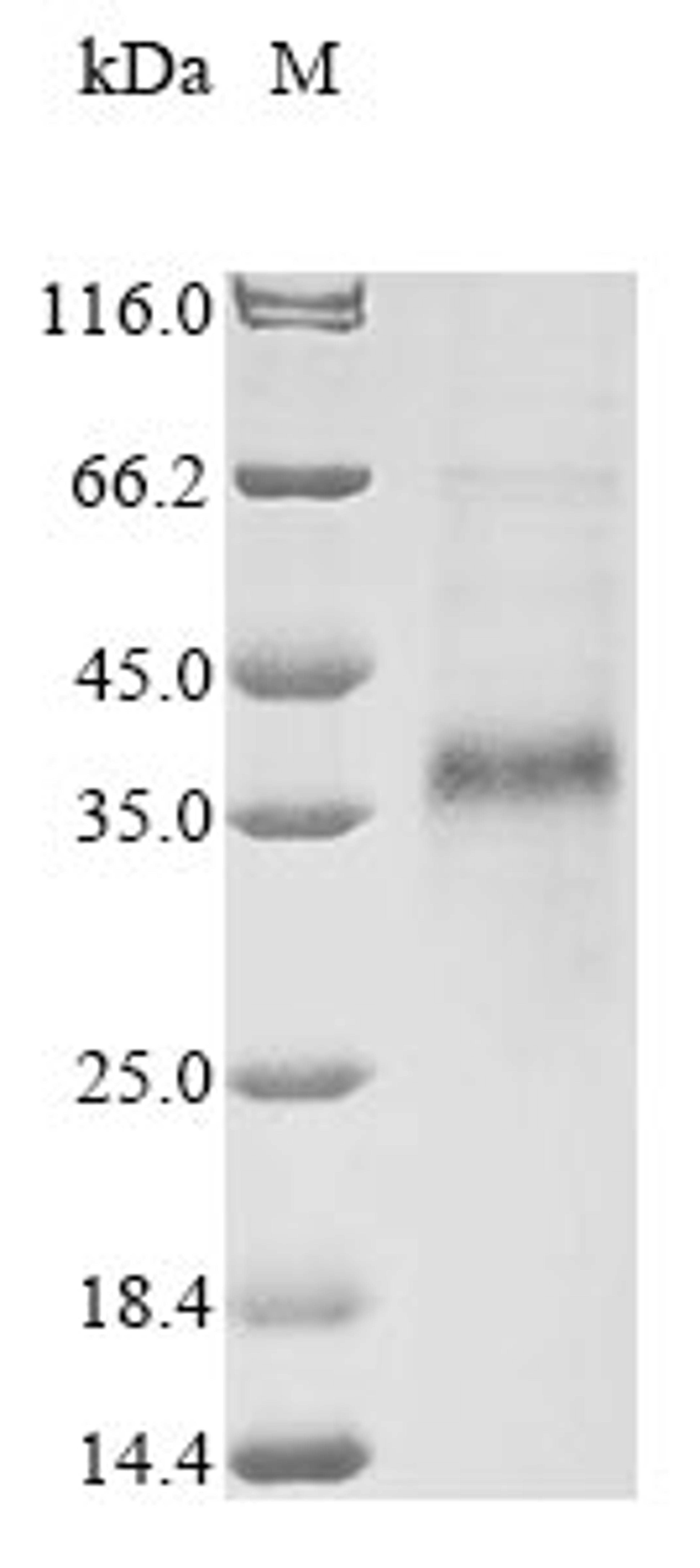 (Tris-Glycine gel) Discontinuous SDS-PAGE (reduced) with 5% enrichment gel and 15% separation gel.